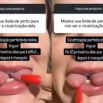 Andressa Urach mostrando a modificação de língua de cobra após modificação estética