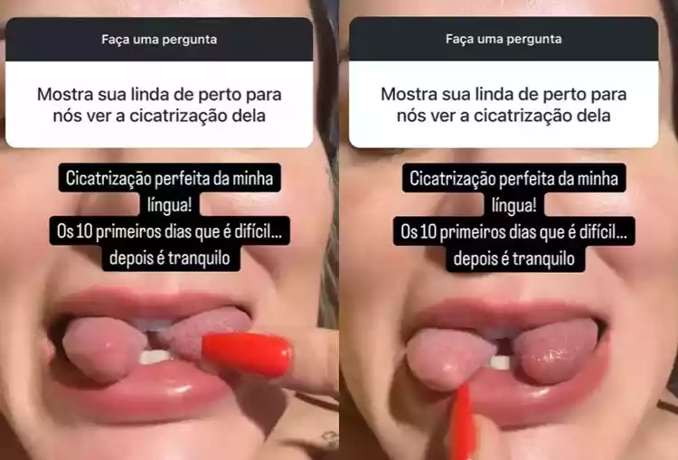 Andressa Urach mostrando a modificação de língua de cobra após modificação estética